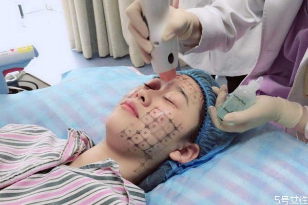 熱瑪吉怎樣是什么 熱瑪吉適應人群