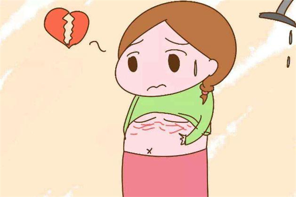 激光去妊娠紋多少錢(qián) 激光去妊娠紋價(jià)格