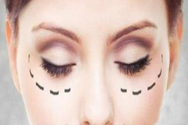 眼袋的壞處 超聲波去眼袋會打麻藥嗎