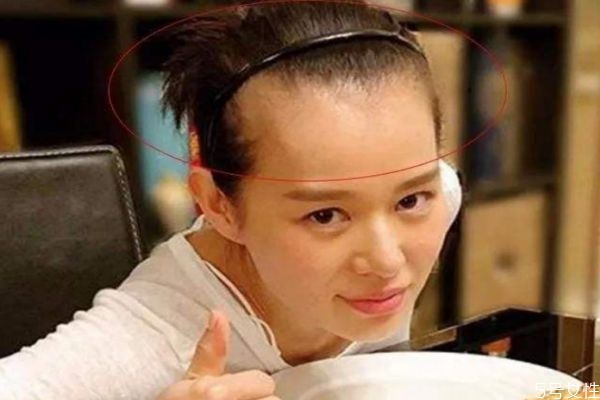 發(fā)際線(xiàn)高適合什么樣的發(fā)型 發(fā)際線(xiàn)后移怎么辦 發(fā)際線(xiàn)高適合什么樣的發(fā)型 發(fā)際線(xiàn)后移怎么辦