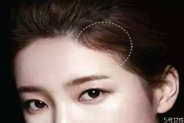 發(fā)際線(xiàn)高適合什么樣的發(fā)型 發(fā)際線(xiàn)后移怎么辦 發(fā)際線(xiàn)高適合什么樣的發(fā)型 發(fā)際線(xiàn)后移怎么辦