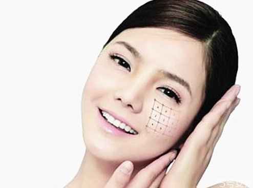 熱瑪吉可以去頸紋嗎 熱瑪吉效果能維持多久 熱瑪吉可以去頸紋嗎 熱瑪吉效果能維持多久