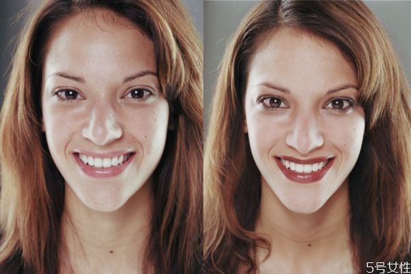 臉上有笑紋怎么辦 笑紋去除最好的方法 臉上有笑紋怎么辦 笑紋去除最好的方法