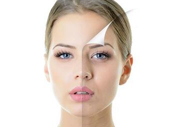 臉上長斑怎么內(nèi)調(diào)效果好 祛斑最有效的8個(gè)偏方