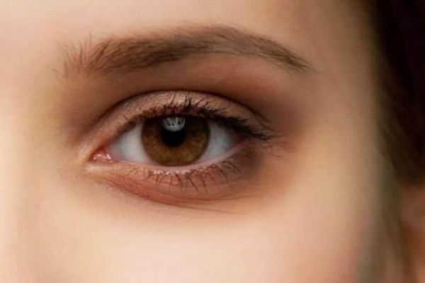 眼睛細紋怎么去掉 去掉眼睛細紋的方法