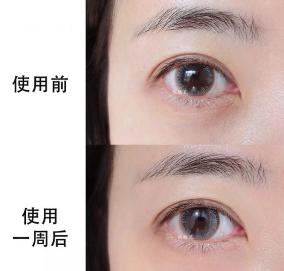 護膚與不護膚的區(qū)別圖 護膚與不護膚的對比差距大嗎