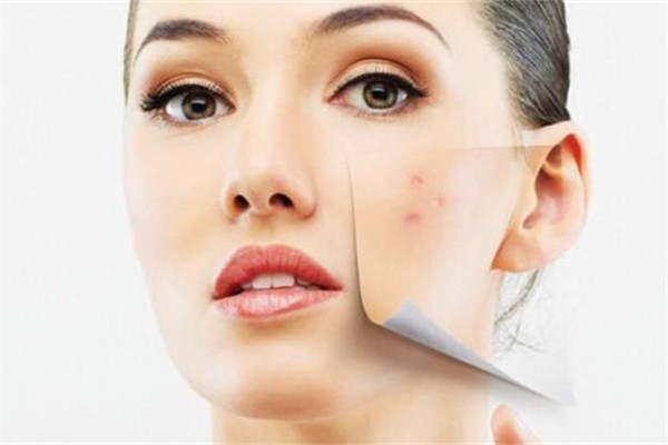 過度護膚的表現(xiàn) 過度護膚后怎么修復(fù)