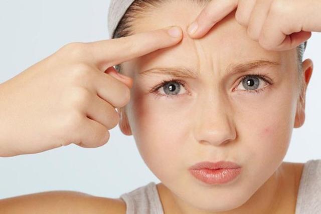 如何預防粉刺閉口 怎么去除粉刺 如何預防粉刺閉口 怎么去除粉刺