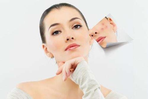 如何預防粉刺閉口 怎么去除粉刺 如何預防粉刺閉口 怎么去除粉刺