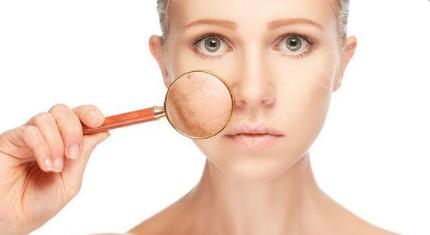 解決毛孔粗大最有效的方法 毛孔粗大怎么修復(fù) 解決毛孔粗大最有效的方法 毛孔粗大怎么修復(fù)