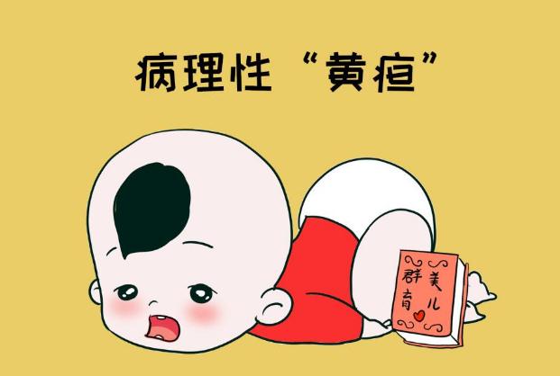 新生兒黃疸是什么原因引起的 新生兒黃疸多久能退完 新生兒黃疸是什么原因引起的 新生兒黃疸多久能退完