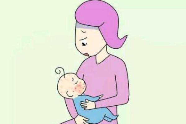 嬰兒濕疹是熱出來的嗎 嬰兒濕疹是什么樣子的 嬰兒濕疹是熱出來的嗎 嬰兒濕疹是什么樣子的