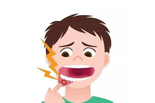 口腔潰瘍怎么治好的最快 口腔潰瘍是什么原因造成 口腔潰瘍怎么治好的最快 口腔潰瘍是什么原因造成