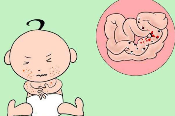 嬰兒過敏嚴(yán)重會怎么樣 嬰兒過敏嚴(yán)重有自愈可能嗎