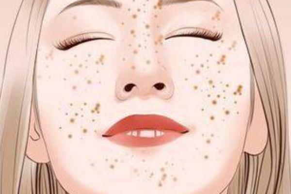 妊娠斑可以去掉嗎 妊娠斑可以用祛斑霜嗎