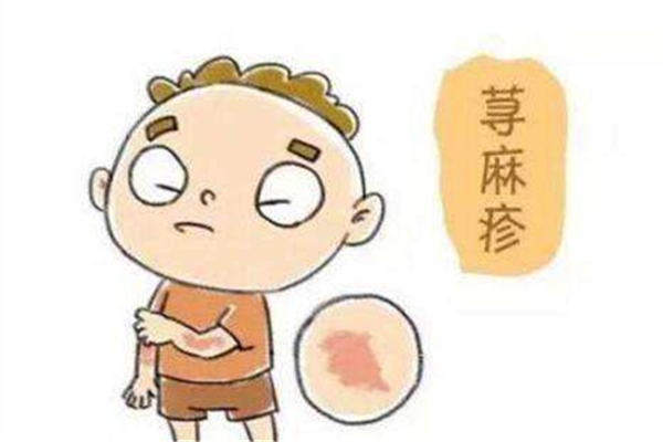 濕氣重會(huì)引起蕁麻疹嗎 濕氣重會(huì)引起皮膚病嗎 濕氣重會(huì)引起蕁麻疹嗎 濕氣重會(huì)引起皮膚病嗎