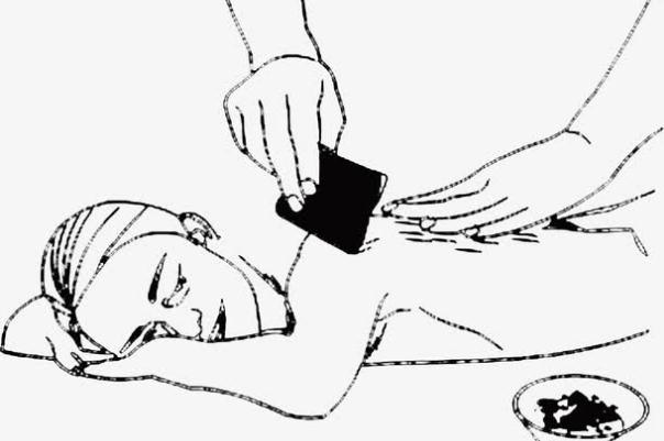 刮痧的原理和作用 刮痧的顏色各代表什么 刮痧的原理和作用 刮痧的顏色各代表什么