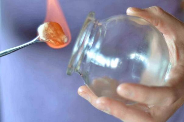 拔火罐能吹空調(diào)嗎 拔火罐能吹風嗎