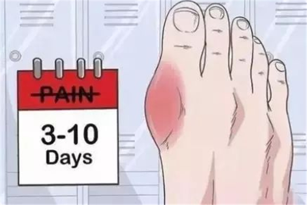 尿酸高對腎功能有影響嗎 尿酸高對腎功能有哪些影響