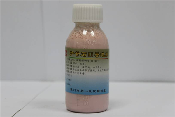 爐甘石洗劑可以治療手上的皰疹嗎 爐甘石能治蕁麻疹嗎 爐甘石洗劑可以治療手上的皰疹嗎 爐甘石能治蕁麻疹嗎