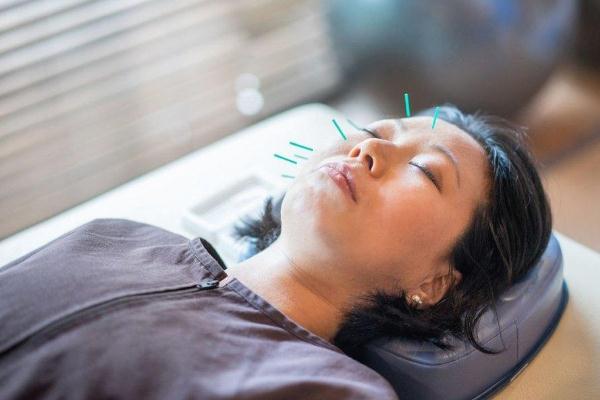 針灸可以去濕氣嗎 針灸可以每天做嗎