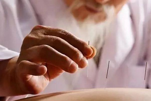針灸對(duì)神經(jīng)損傷恢復(fù)有作用嗎 針灸對(duì)耳鳴治耳鳴有效果嗎