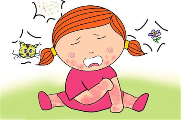 蕁麻疹的過(guò)敏源有哪些 蕁麻疹吃什么好 蕁麻疹的過(guò)敏源有哪些 蕁麻疹吃什么好