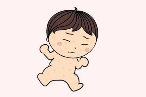 寶寶濕疹會(huì)引起發(fā)燒嗎 寶寶濕疹發(fā)燒怎么辦 寶寶濕疹會(huì)引起發(fā)燒嗎 寶寶濕疹發(fā)燒怎么辦