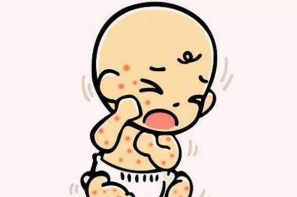 寶寶濕疹會(huì)引起發(fā)燒嗎 寶寶濕疹發(fā)燒怎么辦 寶寶濕疹會(huì)引起發(fā)燒嗎 寶寶濕疹發(fā)燒怎么辦