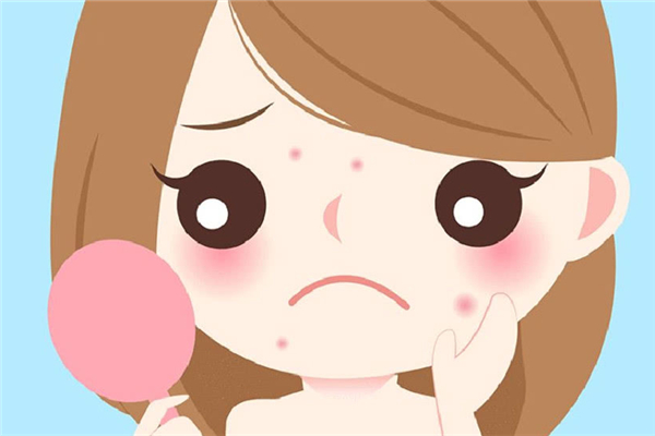 上火會(huì)長(zhǎng)痘痘嗎 上火長(zhǎng)痘痘怎么調(diào)理