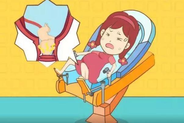 順產(chǎn)和剖腹產(chǎn)哪個對女人好 順產(chǎn)撕裂縫針多久恢復(fù)