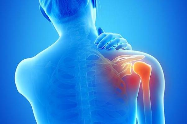 肩周炎怎么治療最快最好方法 肩周炎的癥狀表現(xiàn)