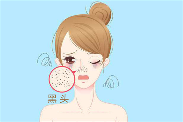 黑頭是怎么產(chǎn)生的 黑頭可以擠嗎 黑頭是怎么產(chǎn)生的 黑頭可以擠嗎