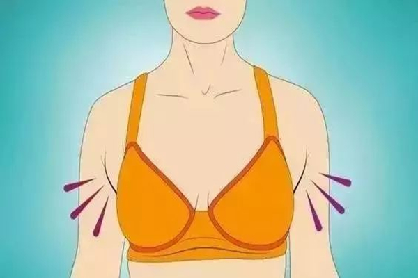 副乳怎么可以消除 副乳有什么危害嗎 副乳怎么可以消除 副乳有什么危害嗎