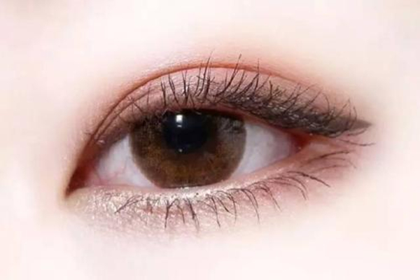 雙眼皮有哪些項目 怎樣選擇適合自己的雙眼皮 雙眼皮有哪些項目 怎樣選擇適合自己的雙眼皮