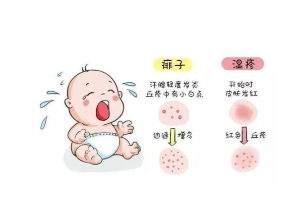 寶寶長痱子用什么擦效果好 寶寶長痱子怎么快速消除止癢 寶寶長痱子用什么擦效果好 寶寶長痱子怎么快速消除止癢