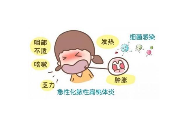 扁桃體發(fā)炎會(huì)引起頭痛嗎 扁桃體發(fā)炎會(huì)自己自愈嗎 扁桃體發(fā)炎會(huì)引起頭痛嗎 扁桃體發(fā)炎會(huì)自己自愈嗎