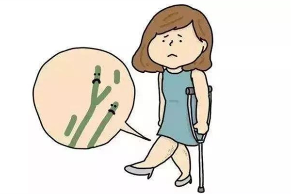 靜脈曲張掛哪個科就診 靜脈曲張去醫(yī)院做什么檢查 靜脈曲張掛哪個科就診 靜脈曲張去醫(yī)院做什么檢查