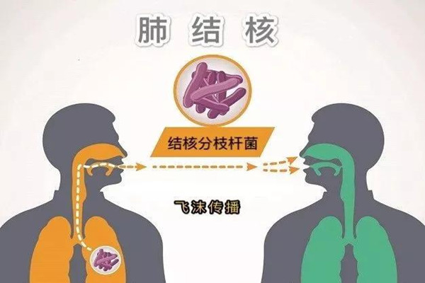 肺結(jié)核會(huì)引起淋巴結(jié)腫大嗎 肺結(jié)核會(huì)引起胸腔積液?jiǎn)?></a>
      <p class=