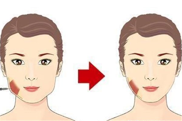 整容會(huì)失敗嗎 整容失敗怎么維護(hù)自己的權(quán)益