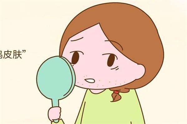 雞皮膚可以刷酸嗎 雞皮膚刷酸多久有效果 雞皮膚可以刷酸嗎 雞皮膚刷酸多久有效果