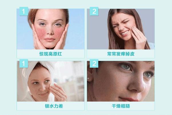 敏感肌怎樣修復(fù)成正常肌膚 敏感肌膚適合什么牌子的護膚品 敏感肌怎樣修復(fù)成正常肌膚 敏感肌膚適合什么牌子的護膚品