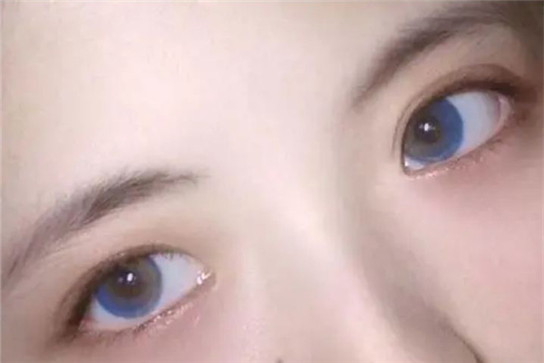 美瞳買回來可以直接佩戴嗎 美瞳買回來后怎么處理 美瞳買回來可以直接佩戴嗎 美瞳買回來后怎么處理