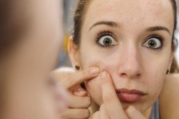 粉刺可以挑出來嗎 粉刺可以自己擠嗎 粉刺可以挑出來嗎 粉刺可以自己擠嗎