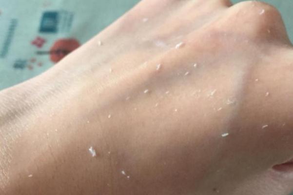 去角質(zhì)對(duì)皮膚有傷害嗎 去角質(zhì)的作用與功效是什么