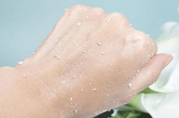 去角質的產品哪款好用 去角質對痘痘有用嗎