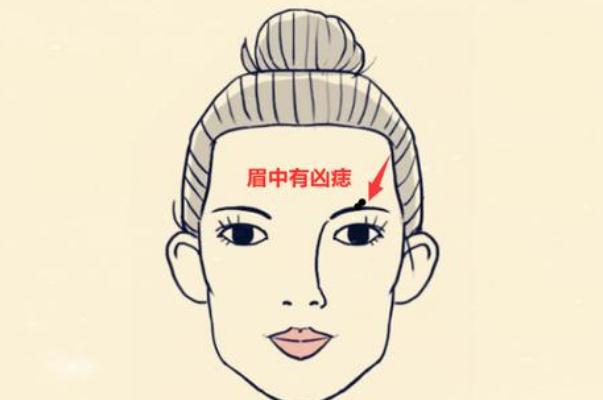 點(diǎn)痣會(huì)不會(huì)復(fù)發(fā) 點(diǎn)痣會(huì)留疤留坑嗎 點(diǎn)痣會(huì)不會(huì)復(fù)發(fā) 點(diǎn)痣會(huì)留疤留坑嗎