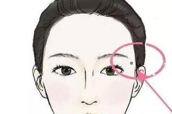 點(diǎn)痣會(huì)不會(huì)復(fù)發(fā) 點(diǎn)痣會(huì)留疤留坑嗎 點(diǎn)痣會(huì)不會(huì)復(fù)發(fā) 點(diǎn)痣會(huì)留疤留坑嗎