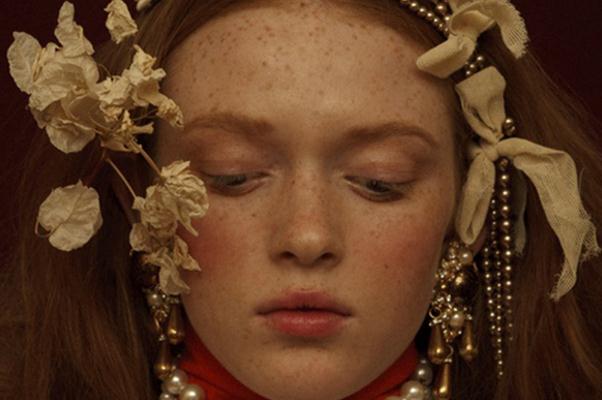 雀斑對(duì)身體有影響嗎 雀斑可以做光子嫩膚嗎 雀斑對(duì)身體有影響嗎 雀斑可以做光子嫩膚嗎