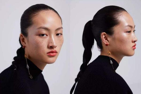 雀斑對(duì)身體有影響嗎 雀斑可以做光子嫩膚嗎 雀斑對(duì)身體有影響嗎 雀斑可以做光子嫩膚嗎